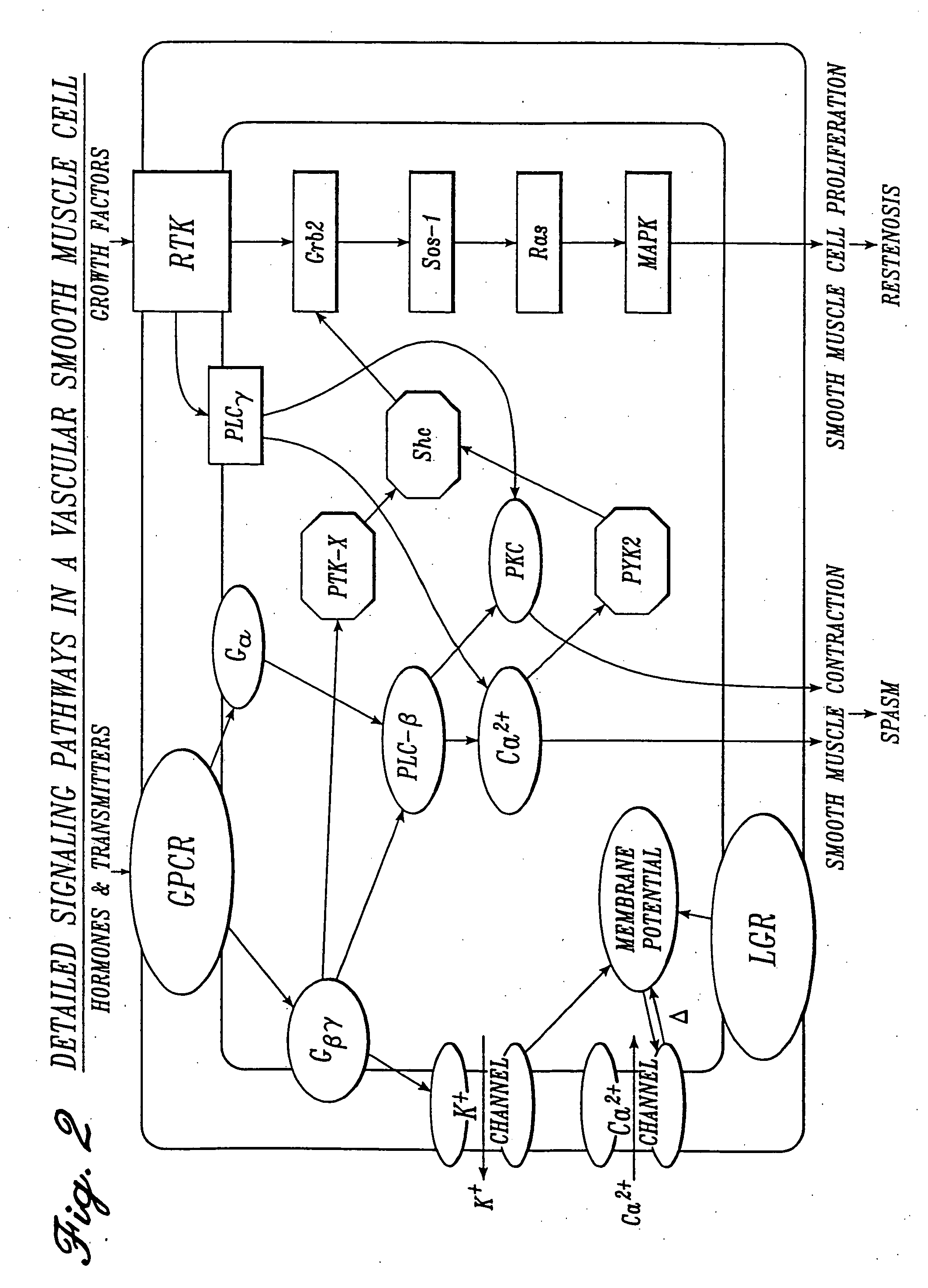 Irrigation solution and method for inhibition of pain, inflammation, spasm and restenosis