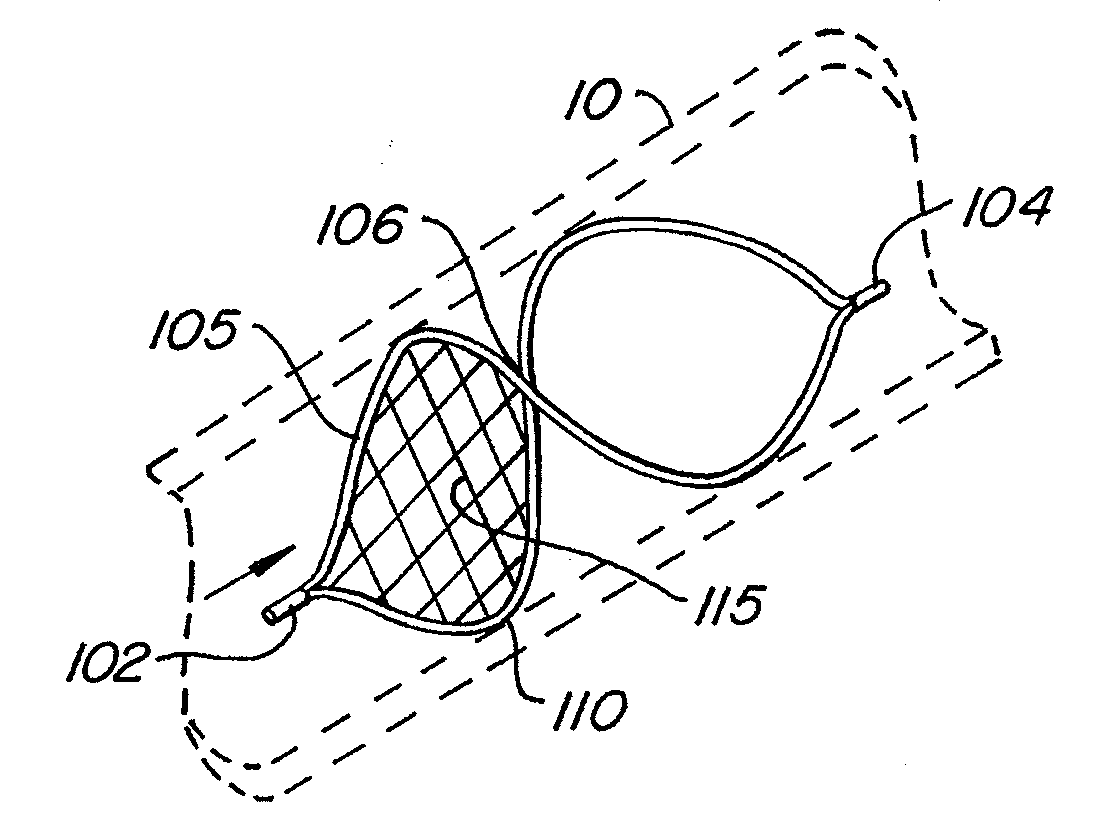 Endoluminal Filter With Fixation