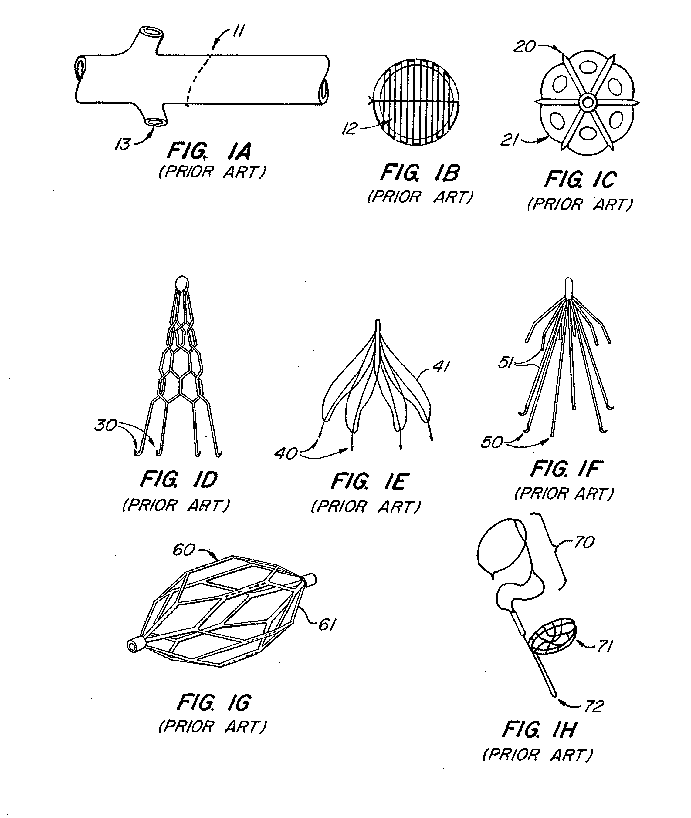 Endoluminal Filter With Fixation