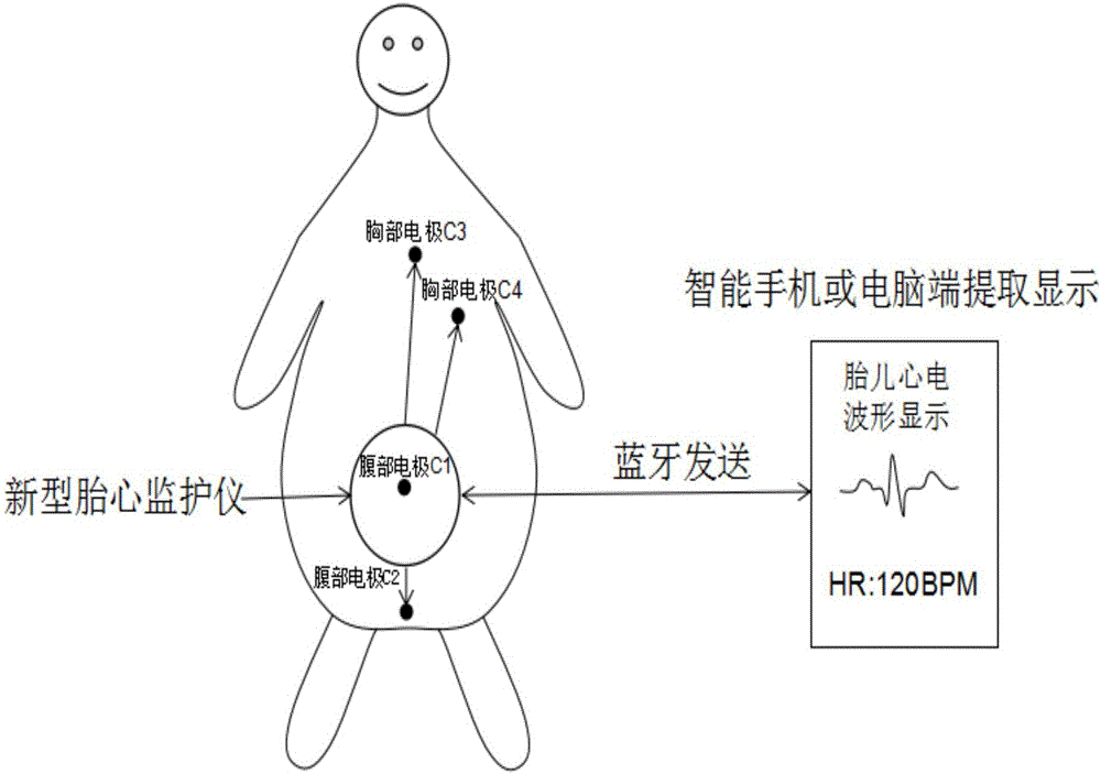 Fetal electrocardiogram circuit system