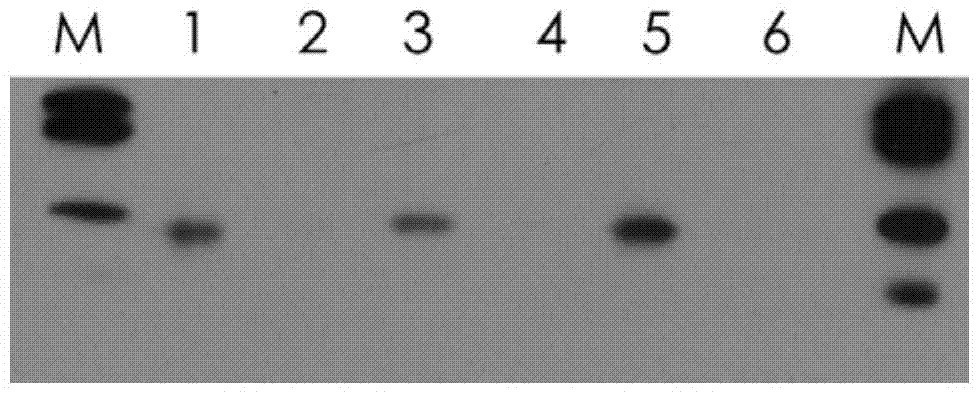 A kind of preparation method of 1-1 type human plasma haptoglobin extract