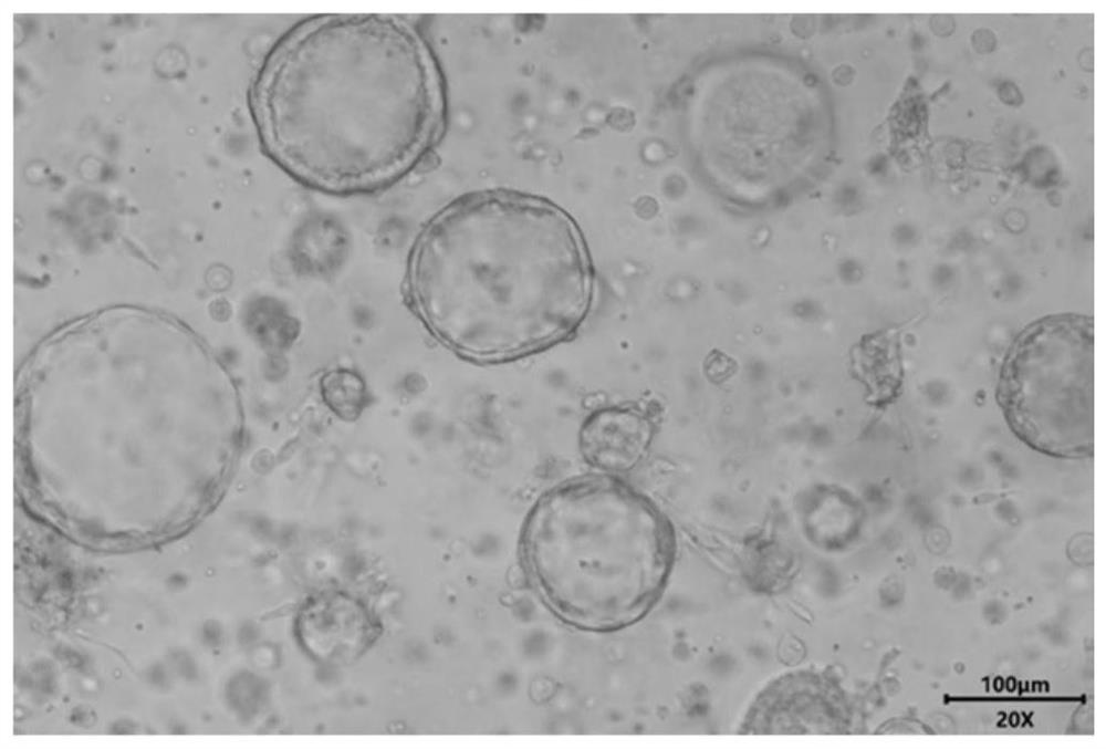 Animal lung bud organoid culture medium and culture method