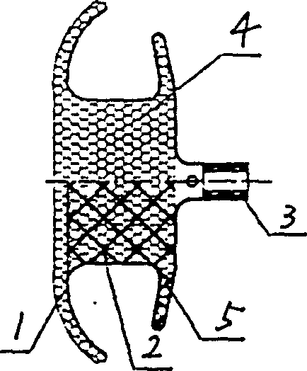 Ventricular septal defect blocking apparatus and its making method