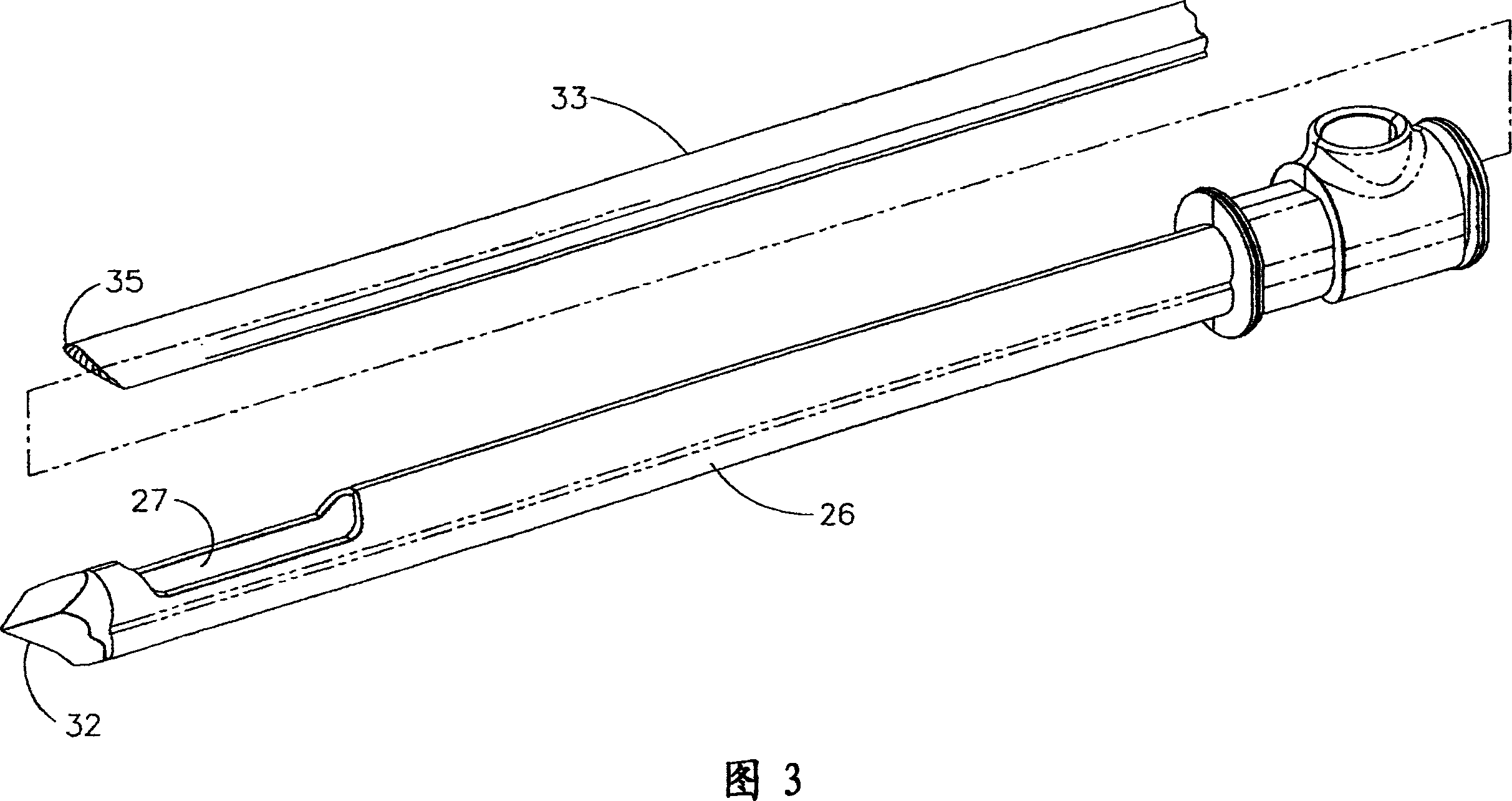 Device for minimally invasive internal tissue removal