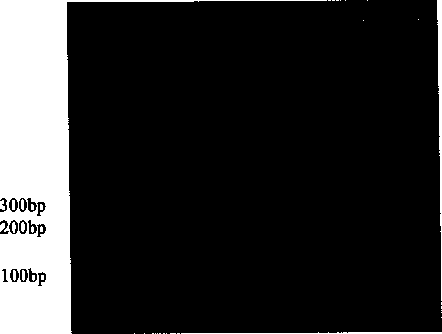 Y chromosome microdeletion diagnosis and method for carrying out PCR amplification