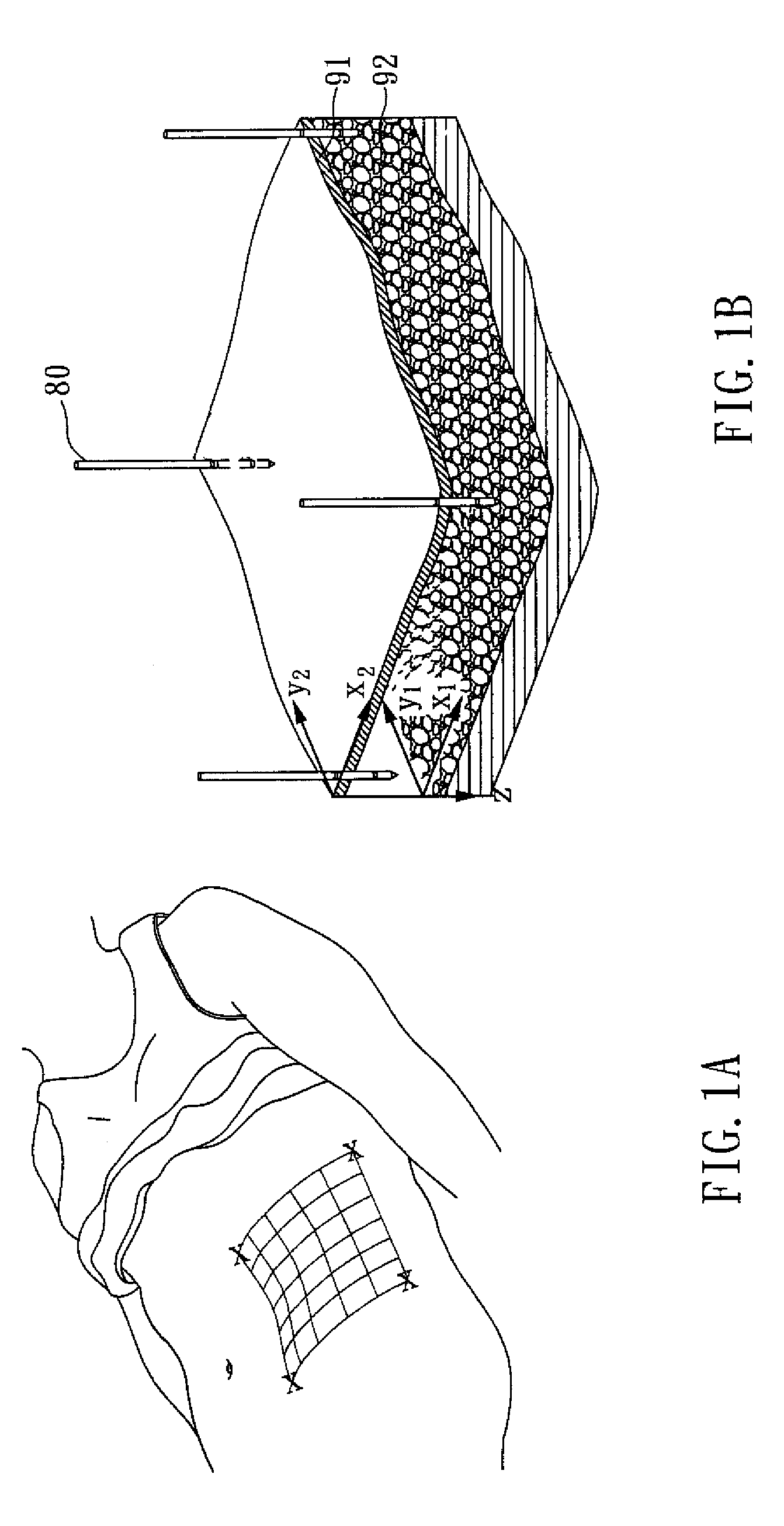 Automatic fat removal device