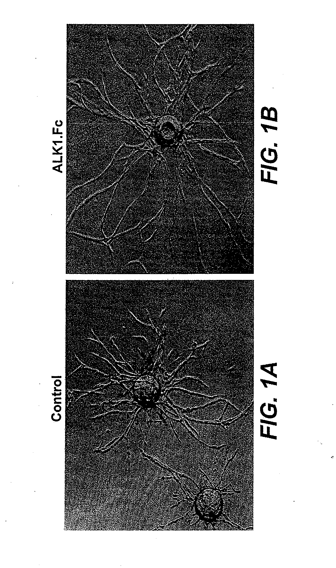 Activin receptor-like kinase-1 compositions and methods of use