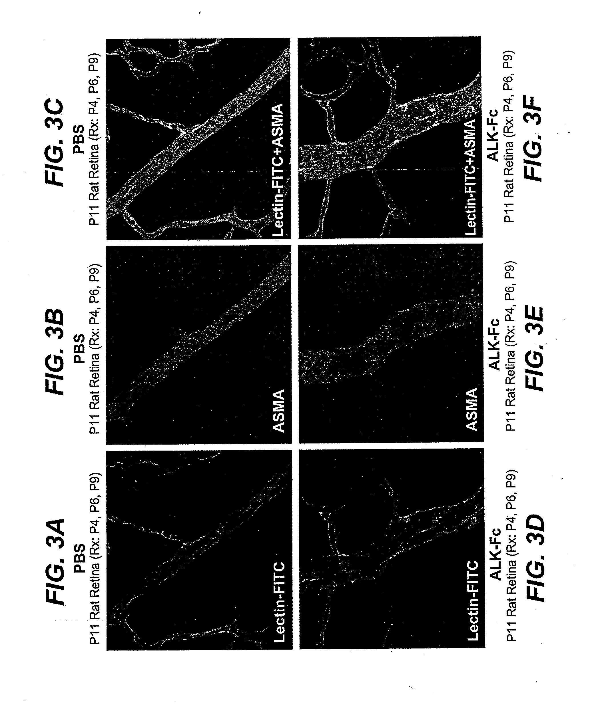 Activin receptor-like kinase-1 compositions and methods of use