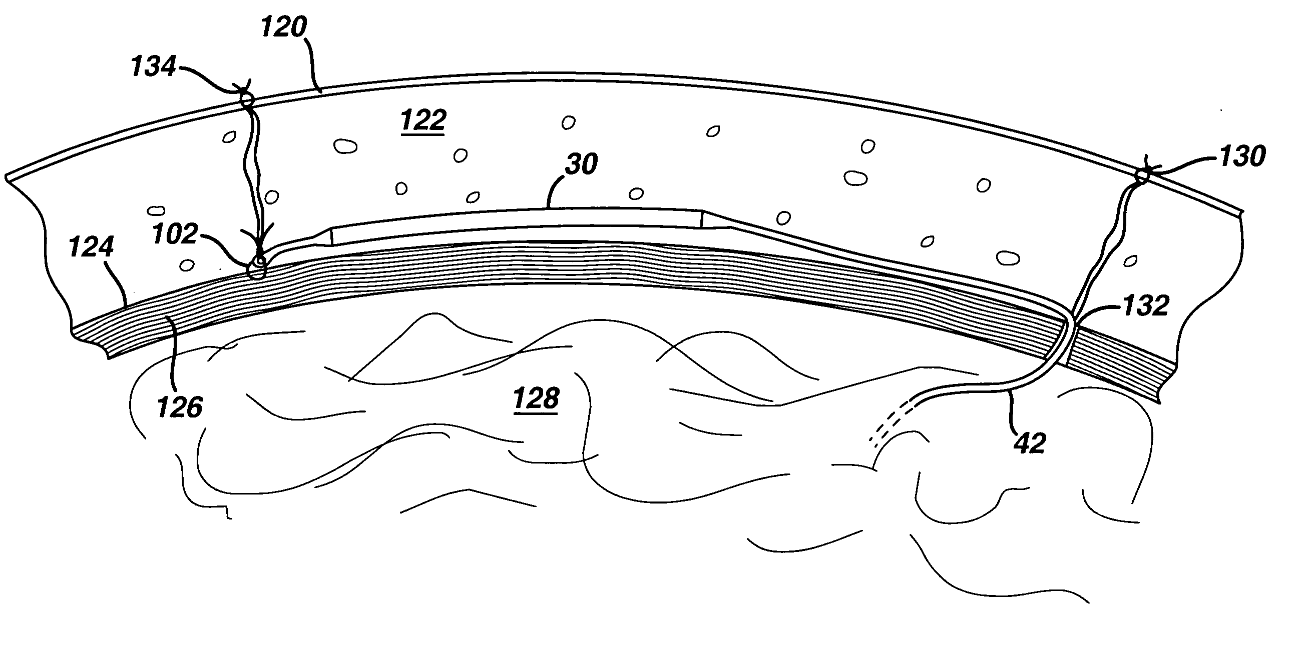 Flexible injection port