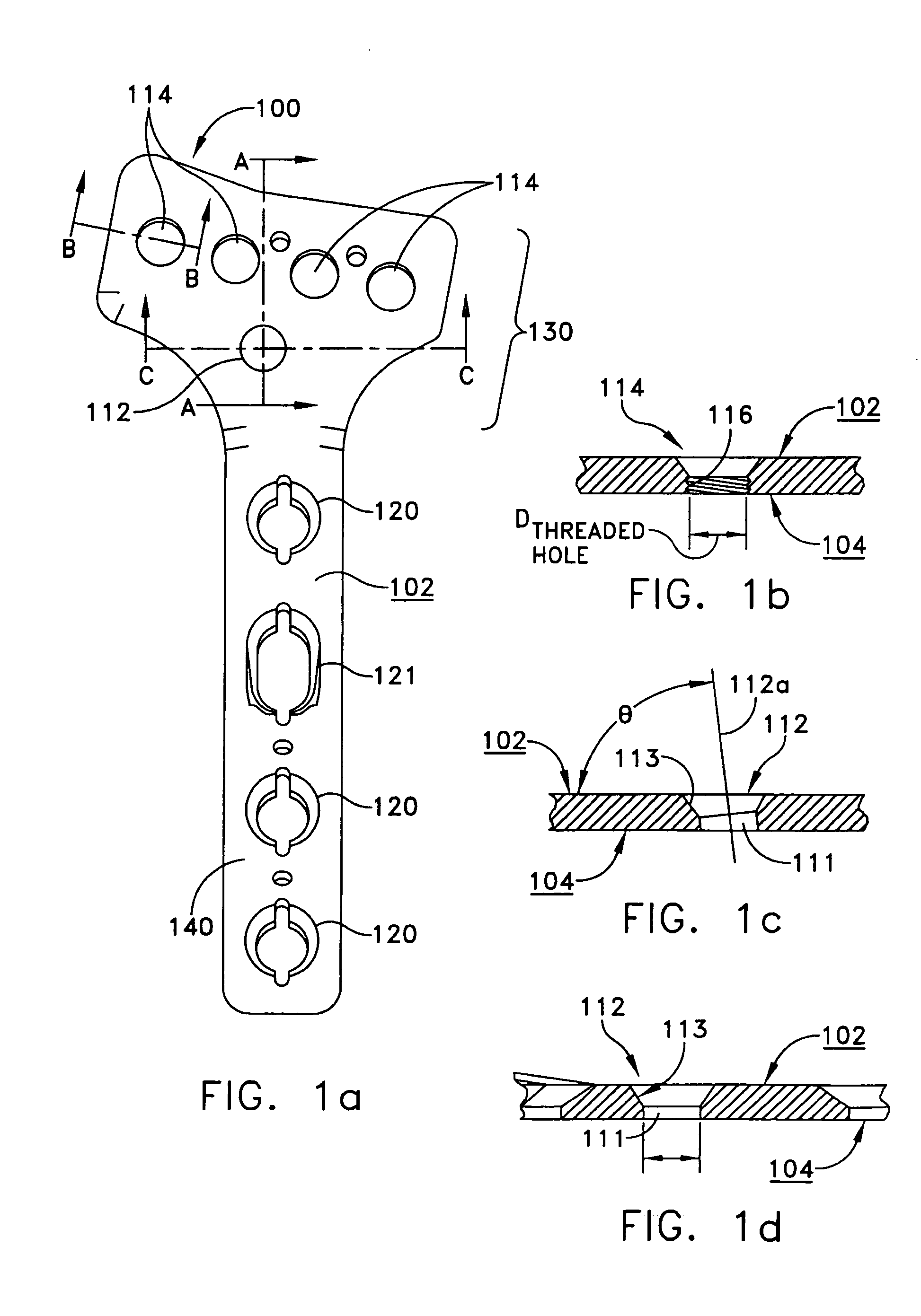 Distal radius bone plating system with locking and non-locking screws