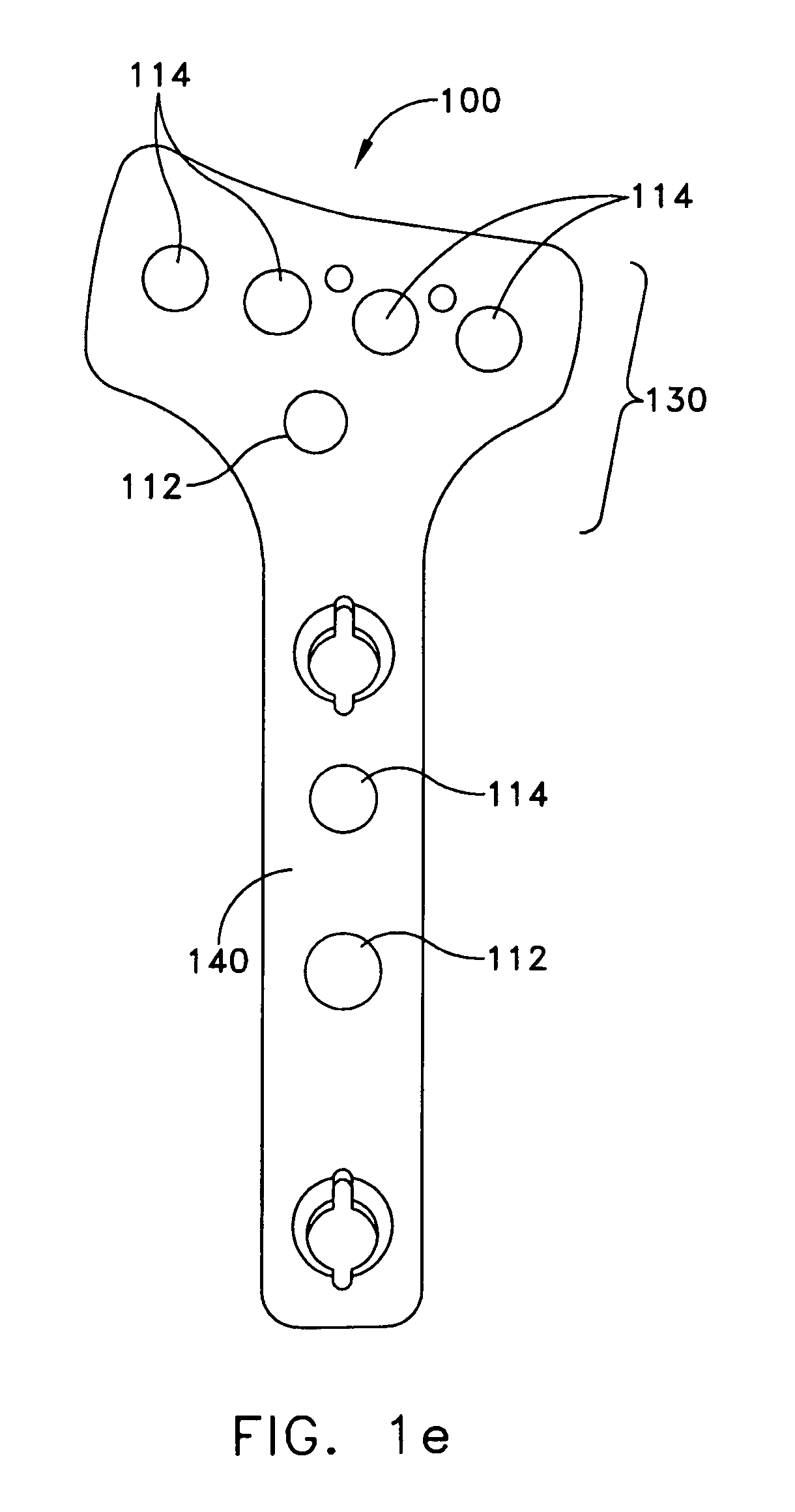 Distal radius bone plating system with locking and non-locking screws