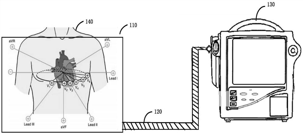 Method, device, equipment, and medium for qrs wave group verification of multi-lead ECG signals