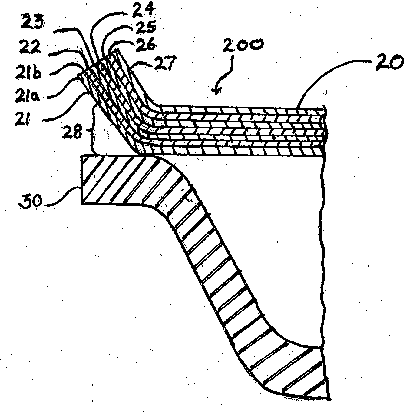 Peelable vacuum skin packages