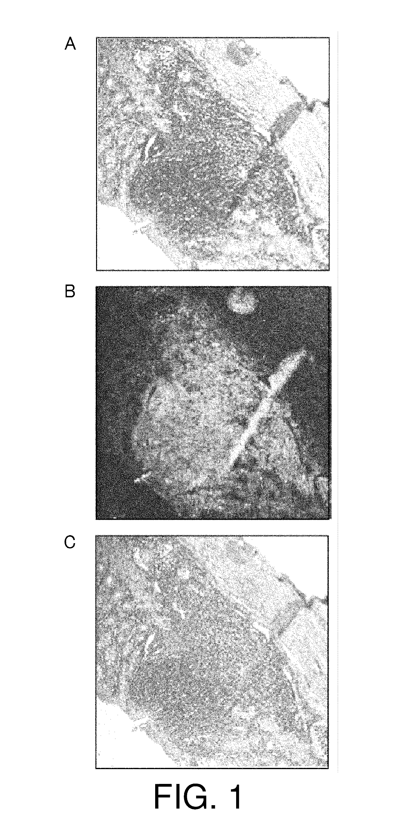 Method of fixing and expressing physiologically active substance