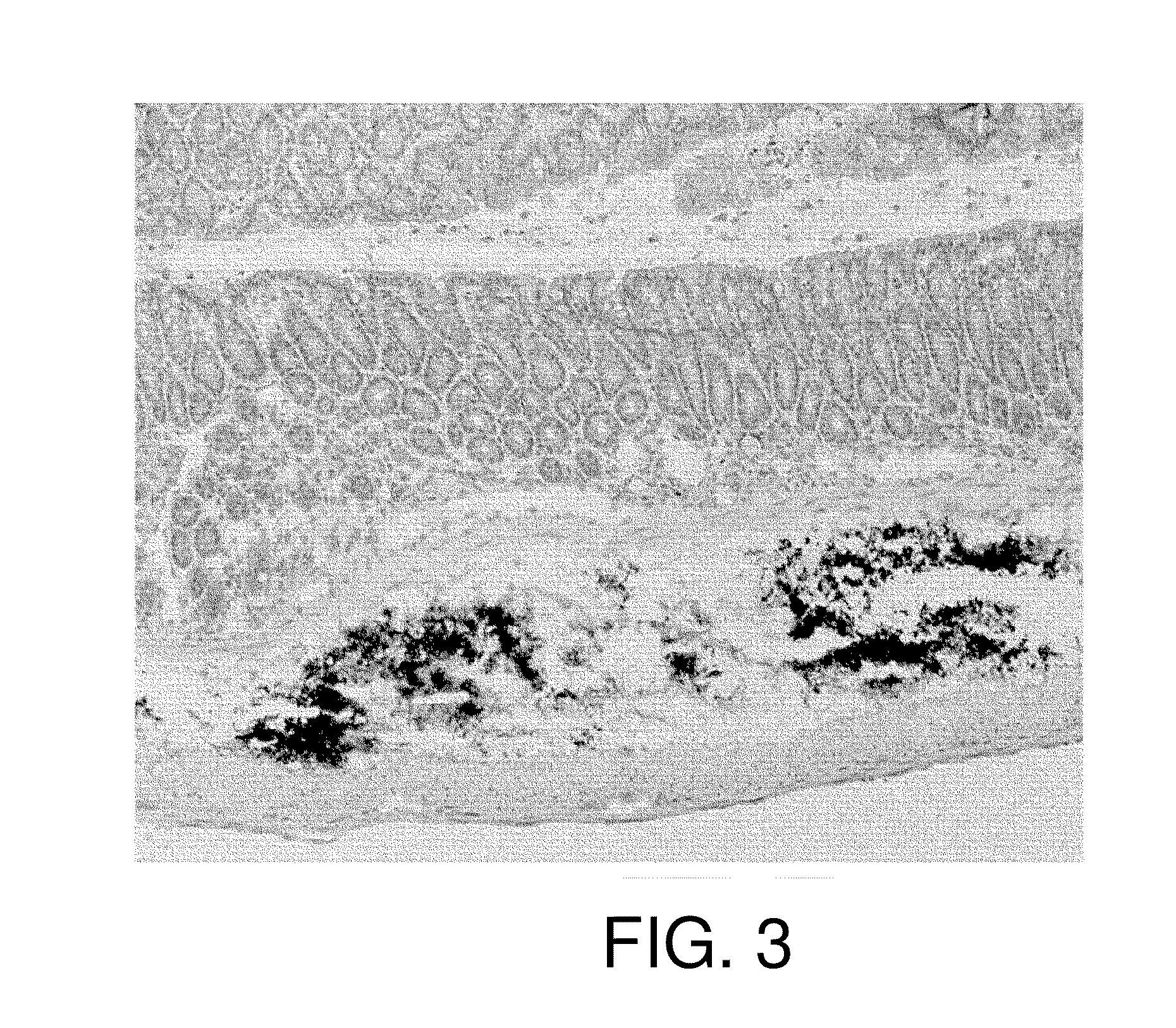 Method of fixing and expressing physiologically active substance