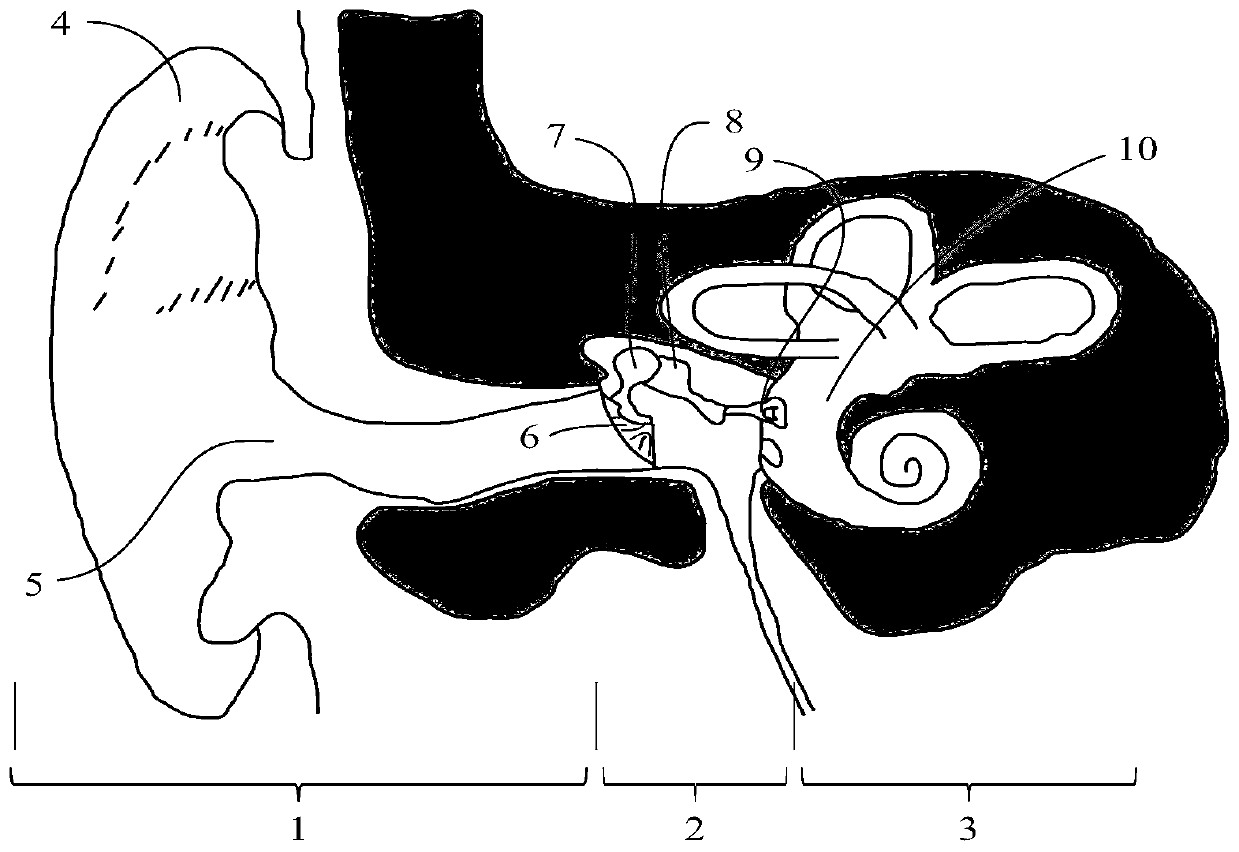 A Fluid-Coupled Actuator Exciting a Round Window Membrane