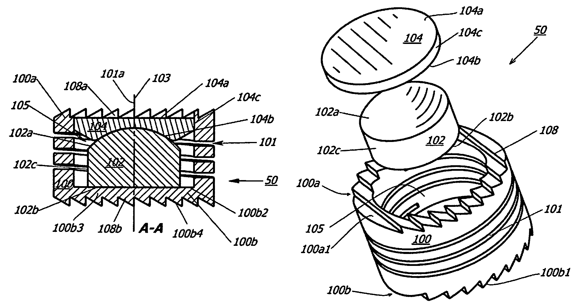 Intervertebral disc replacement prosthesis