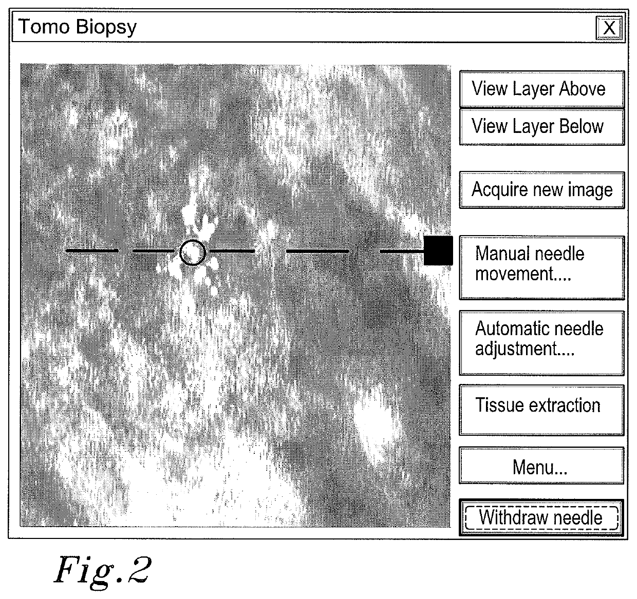 Method and arrangement relating to x-ray imaging