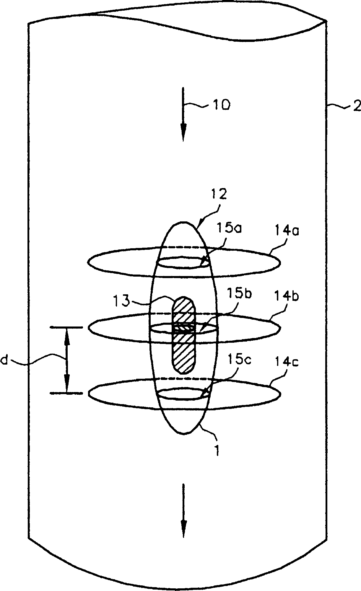 Optical projection imaging system and method for automatically detecting cells with molecular marker compartmentalization associated with malignancy and disease