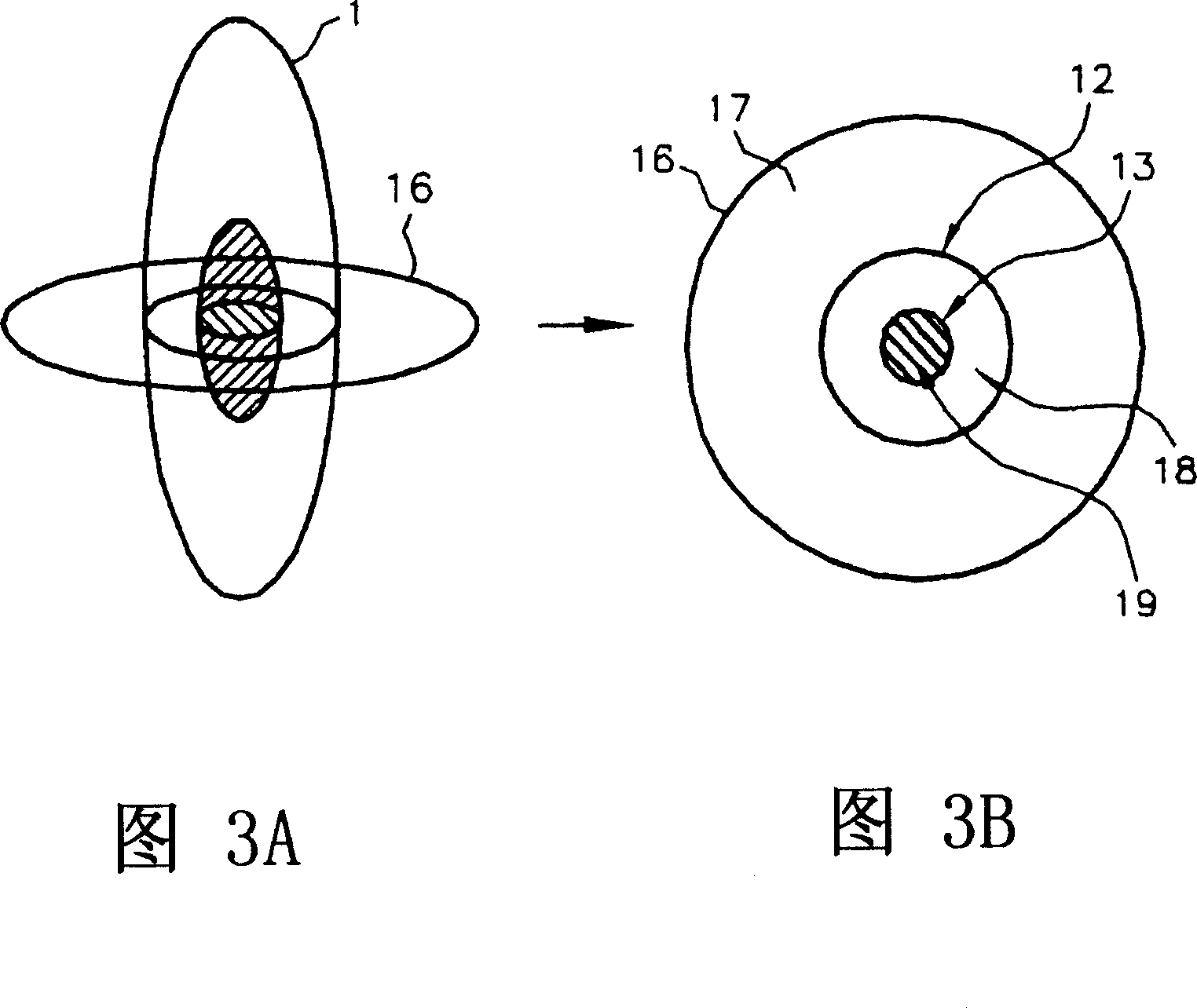 Optical projection imaging system and method for automatically detecting cells with molecular marker compartmentalization associated with malignancy and disease