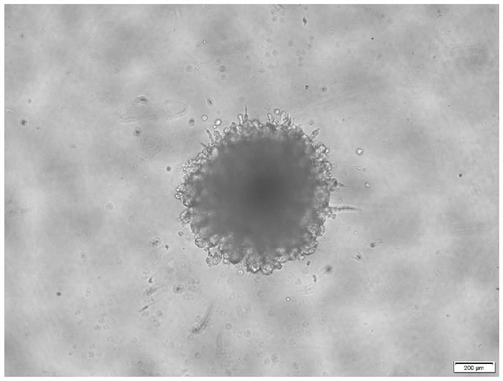 Preparation and application method of double network hydrogel for tumor microsphere invasion detection