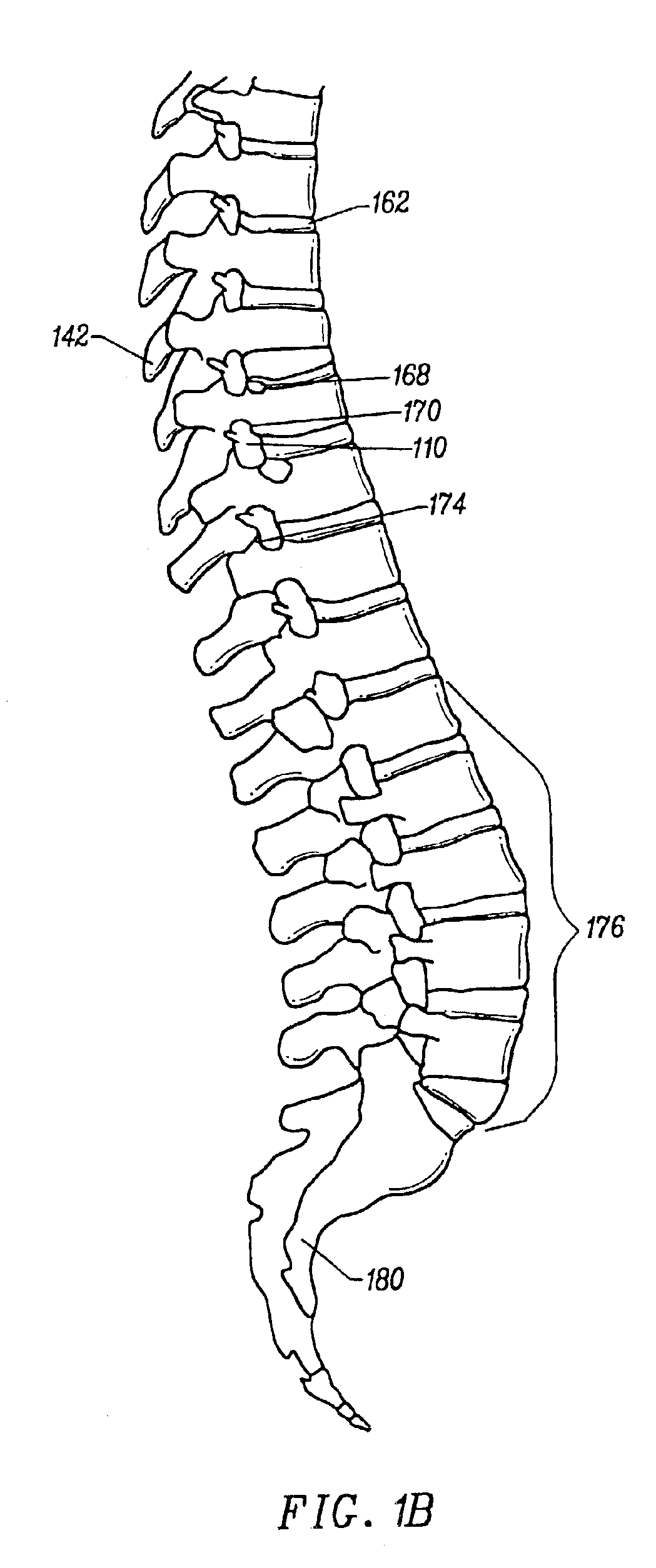 Method and apparatus for treating annular fissures in intervertebral discs