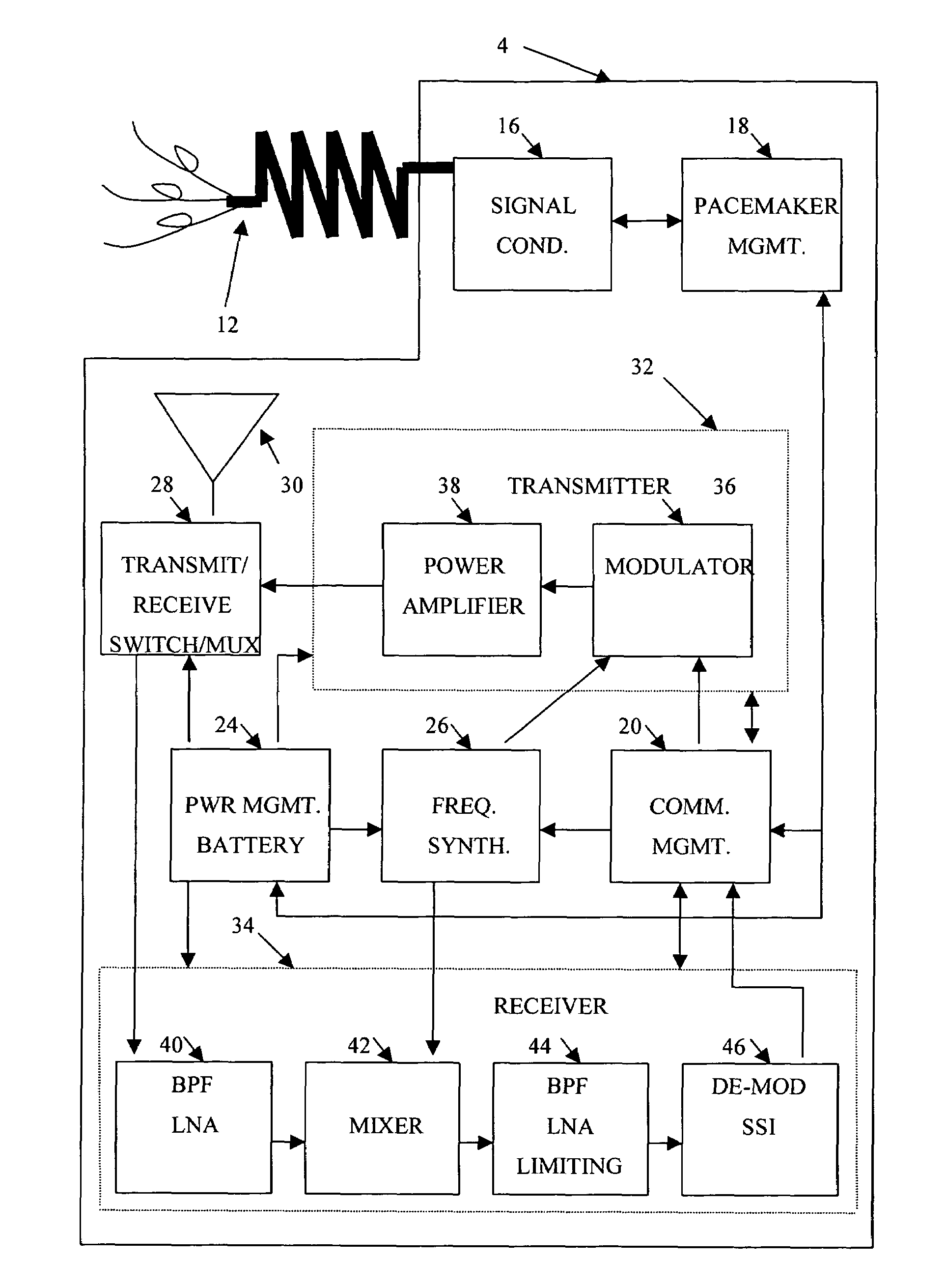 High frequency wireless pacemaker