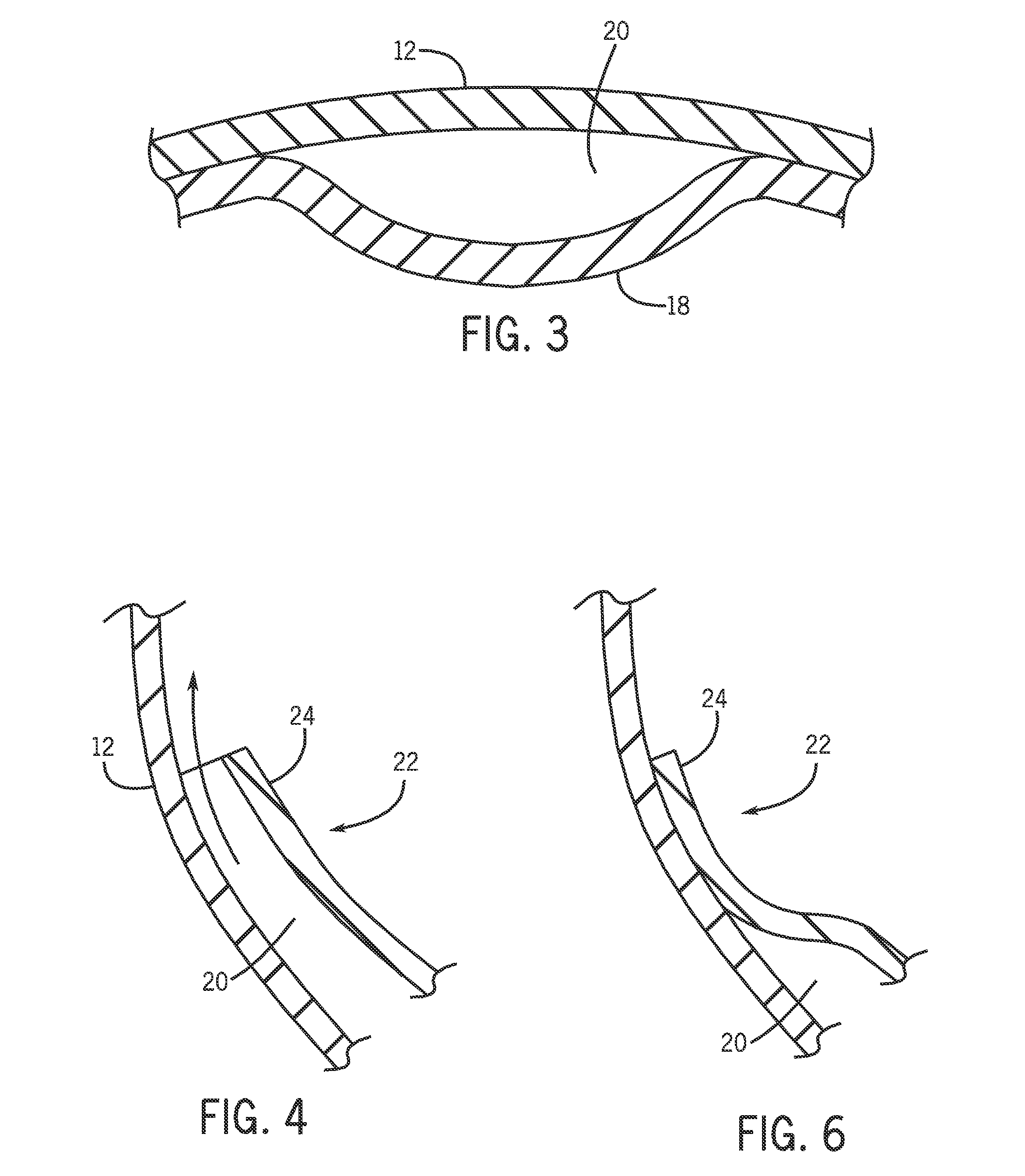 Water balloon system