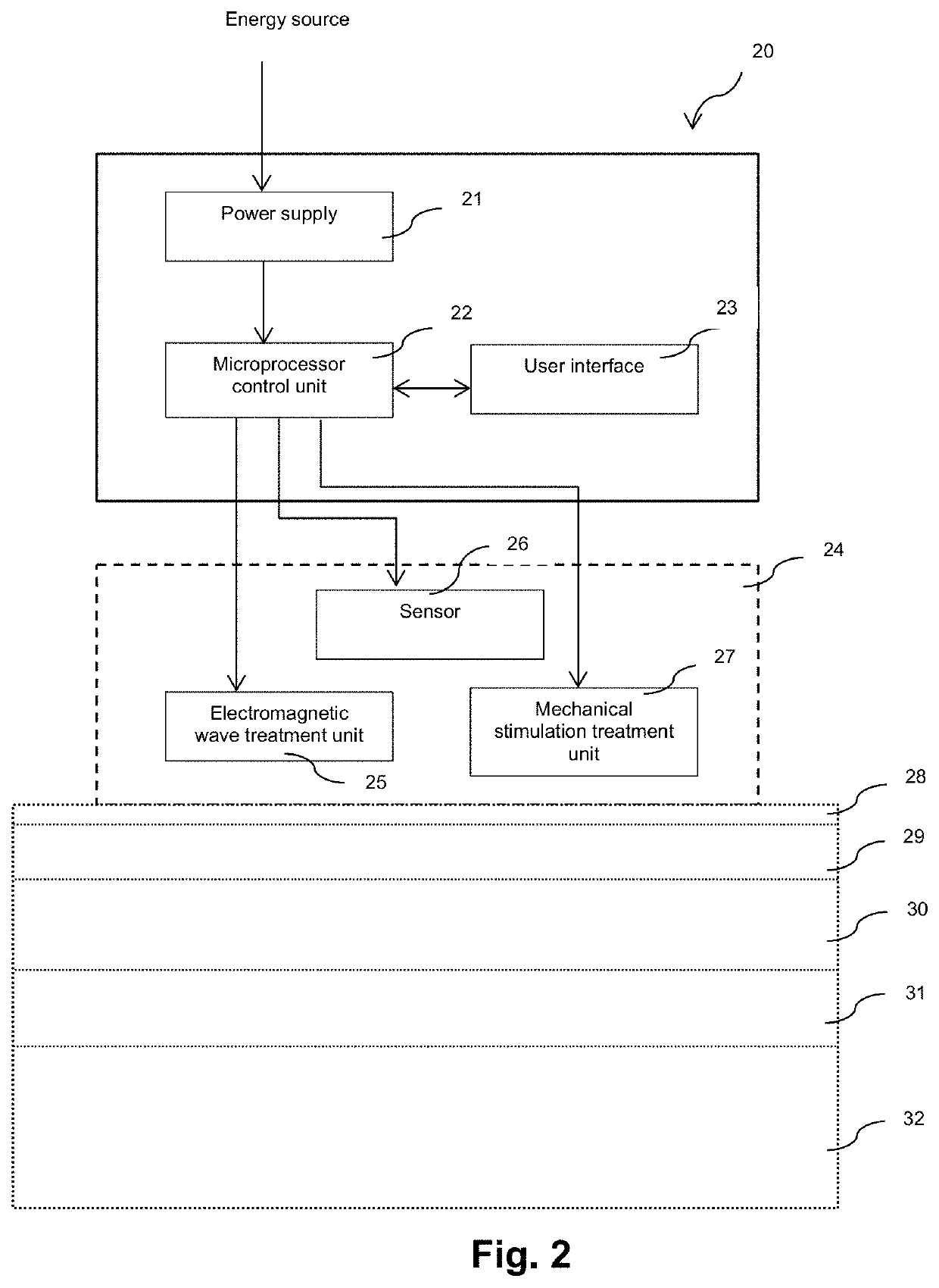 Methods and devices for tissue treatment using mechanical stimulation and electromagnetic field