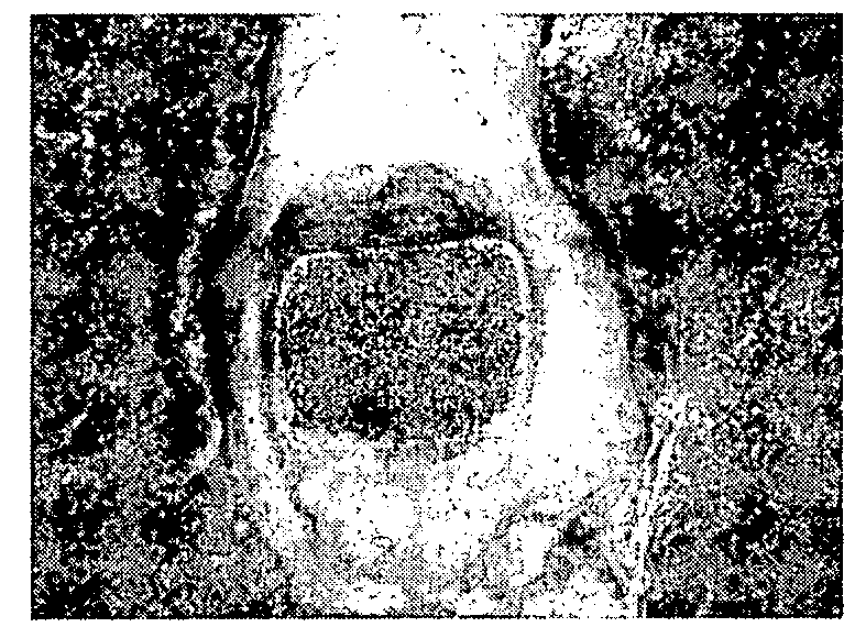 Methods of identifying orthodontic adhesives