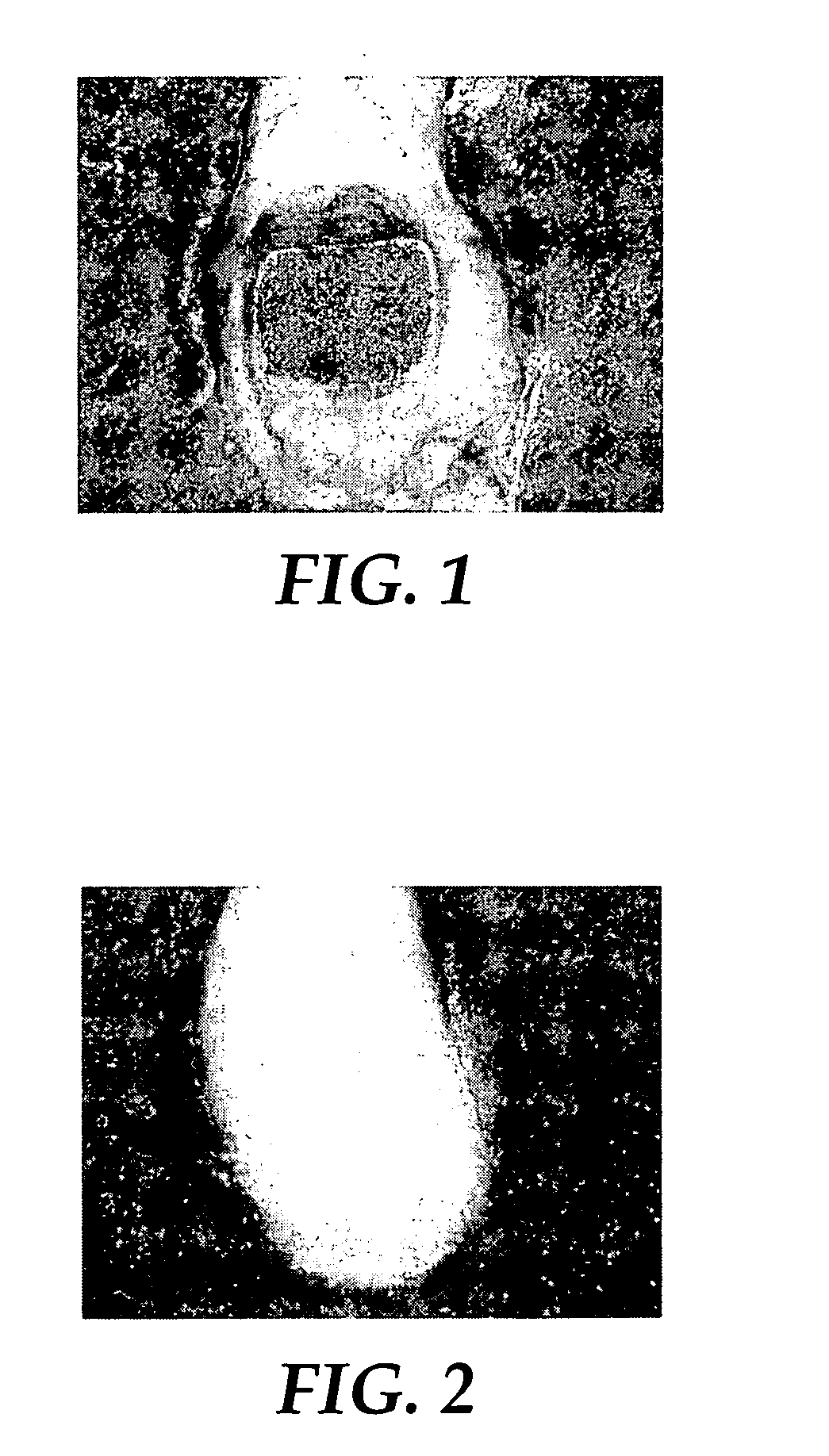 Methods of identifying orthodontic adhesives