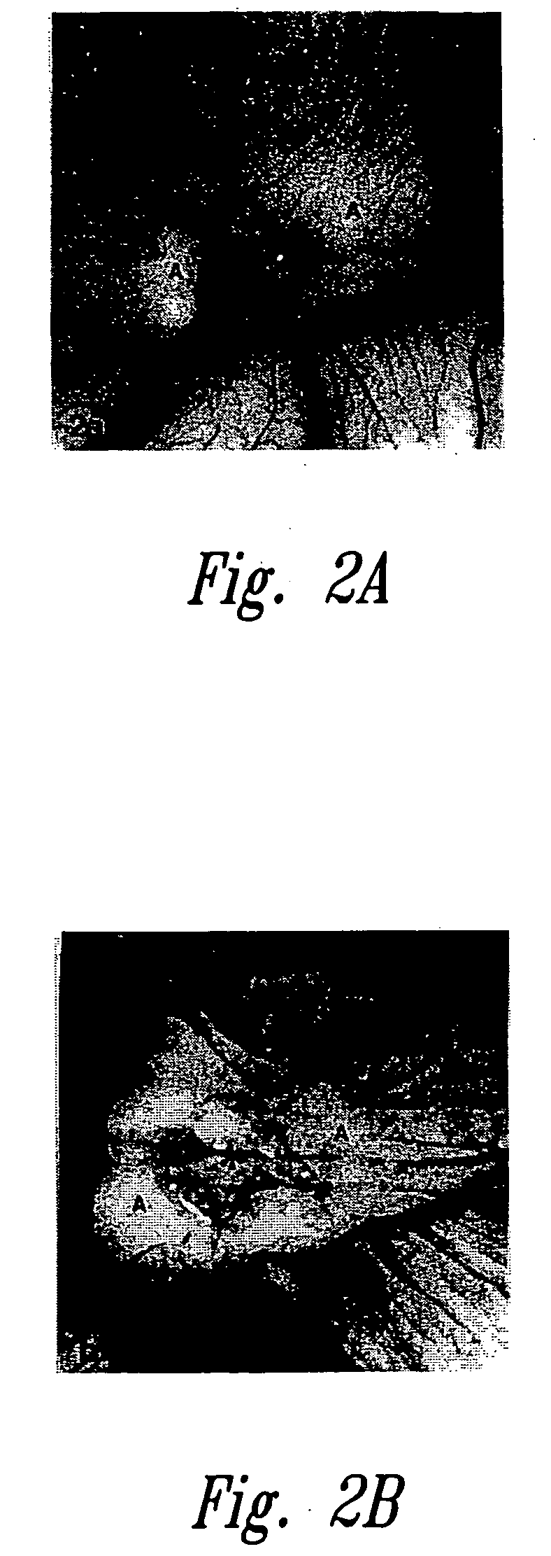 Anti-angiogenic compositions and methods of use