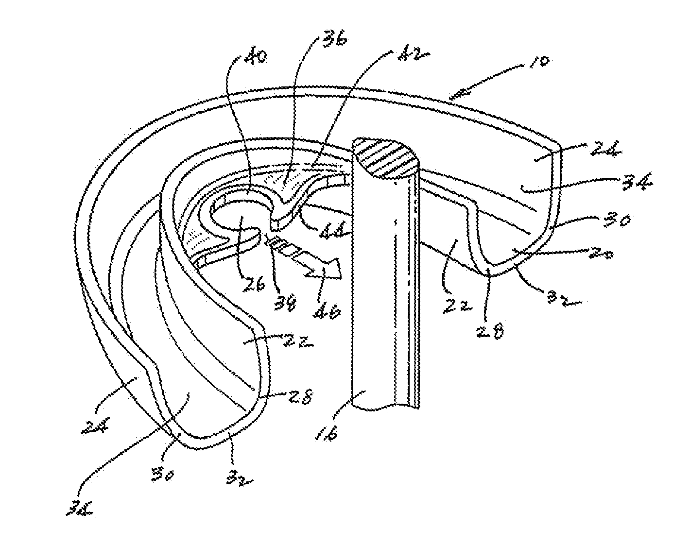 Mouth guard