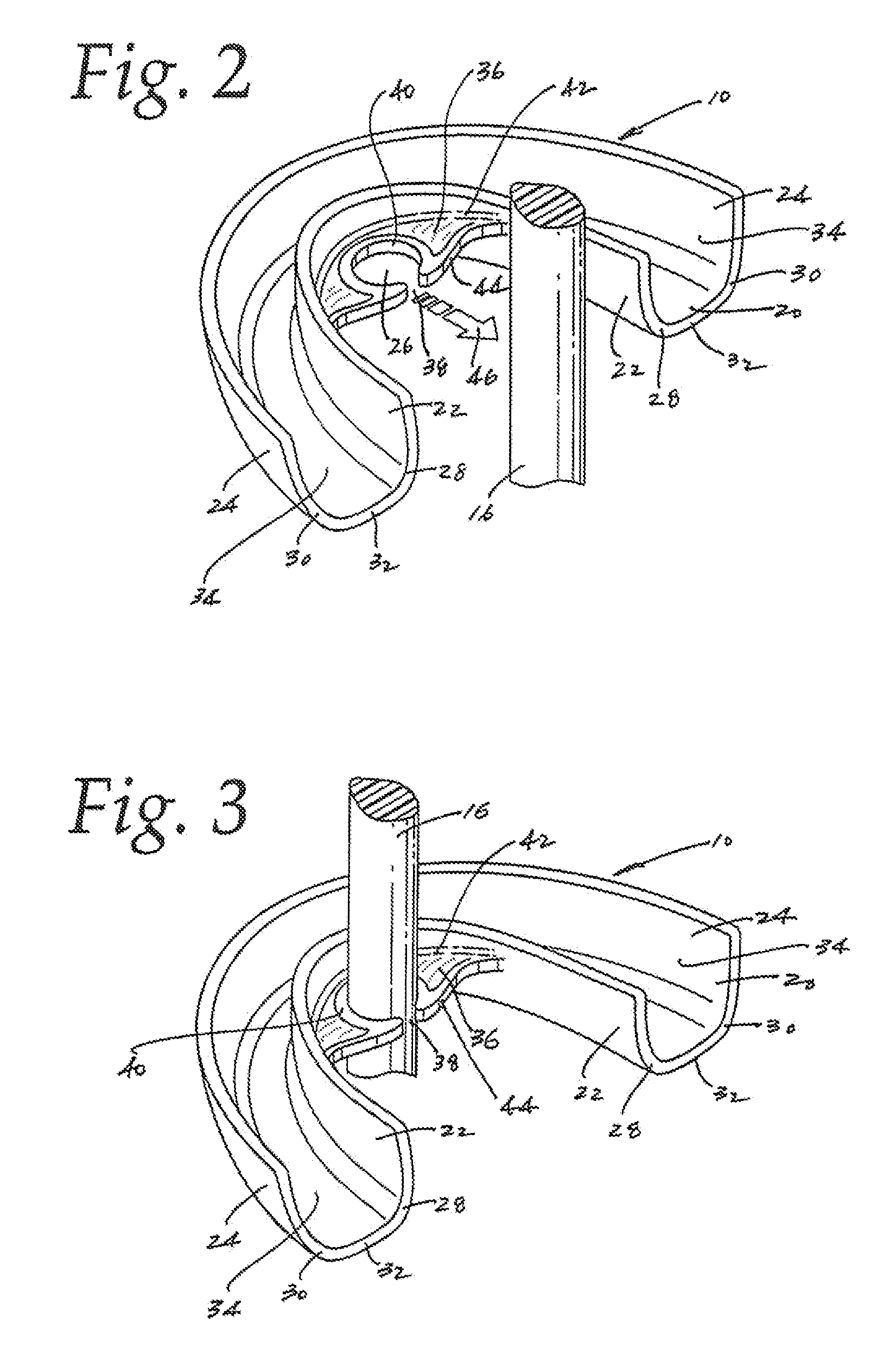 Mouth guard