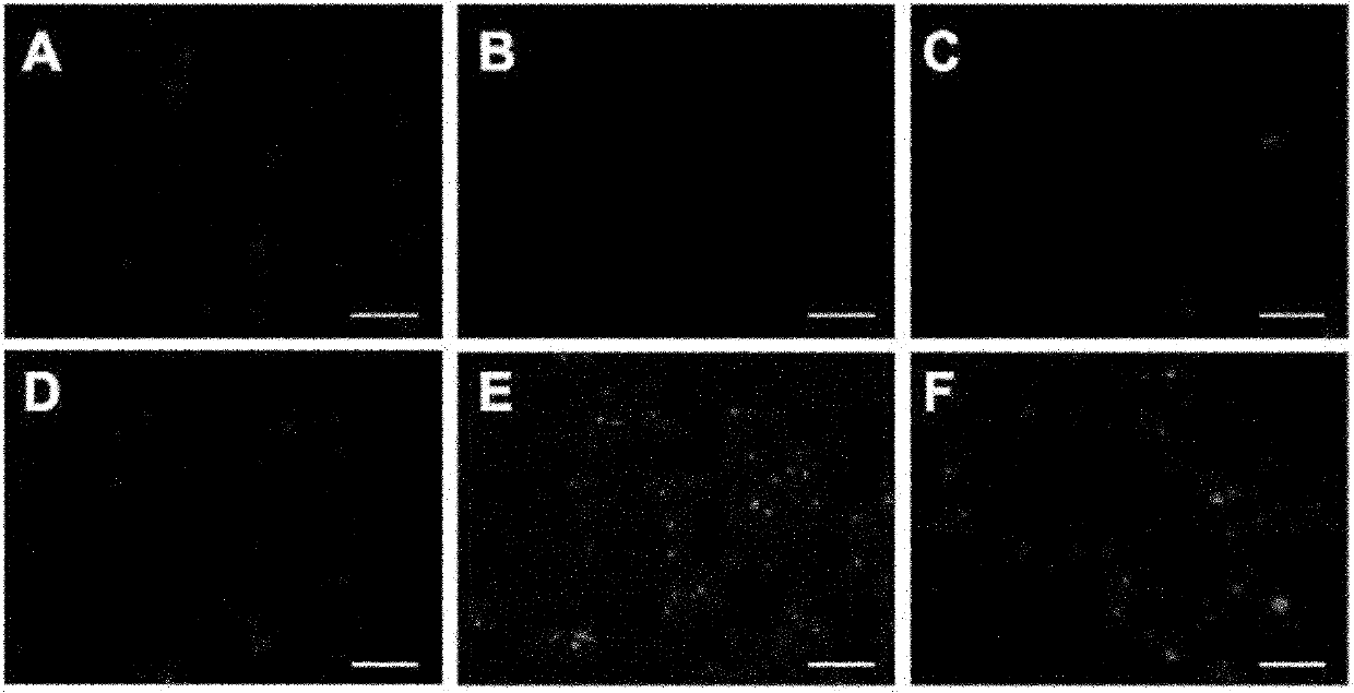 Tumor targeting magnetic resonance contrast medium modified by chlorotoxin and preparation method and application thereof