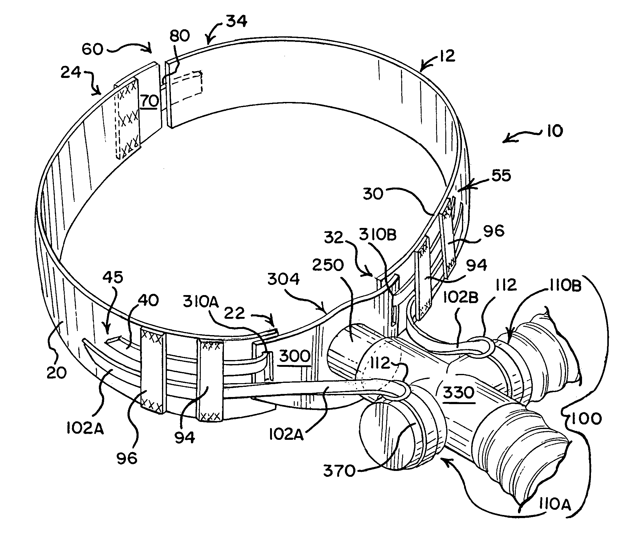 Tracheal tube anti-disconnect device