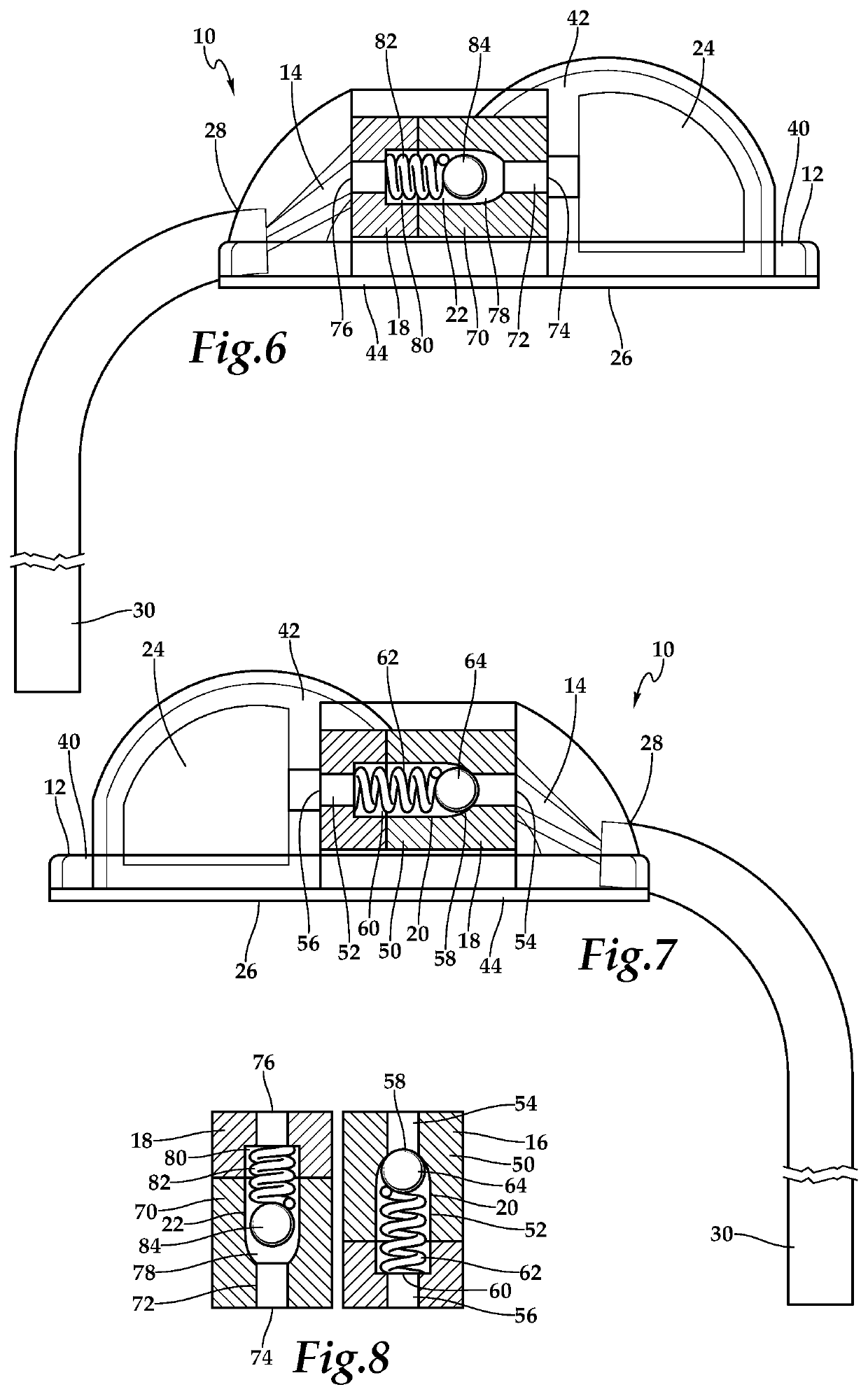 Implantable intracranial pulse pressure modulator and system and method for use of same