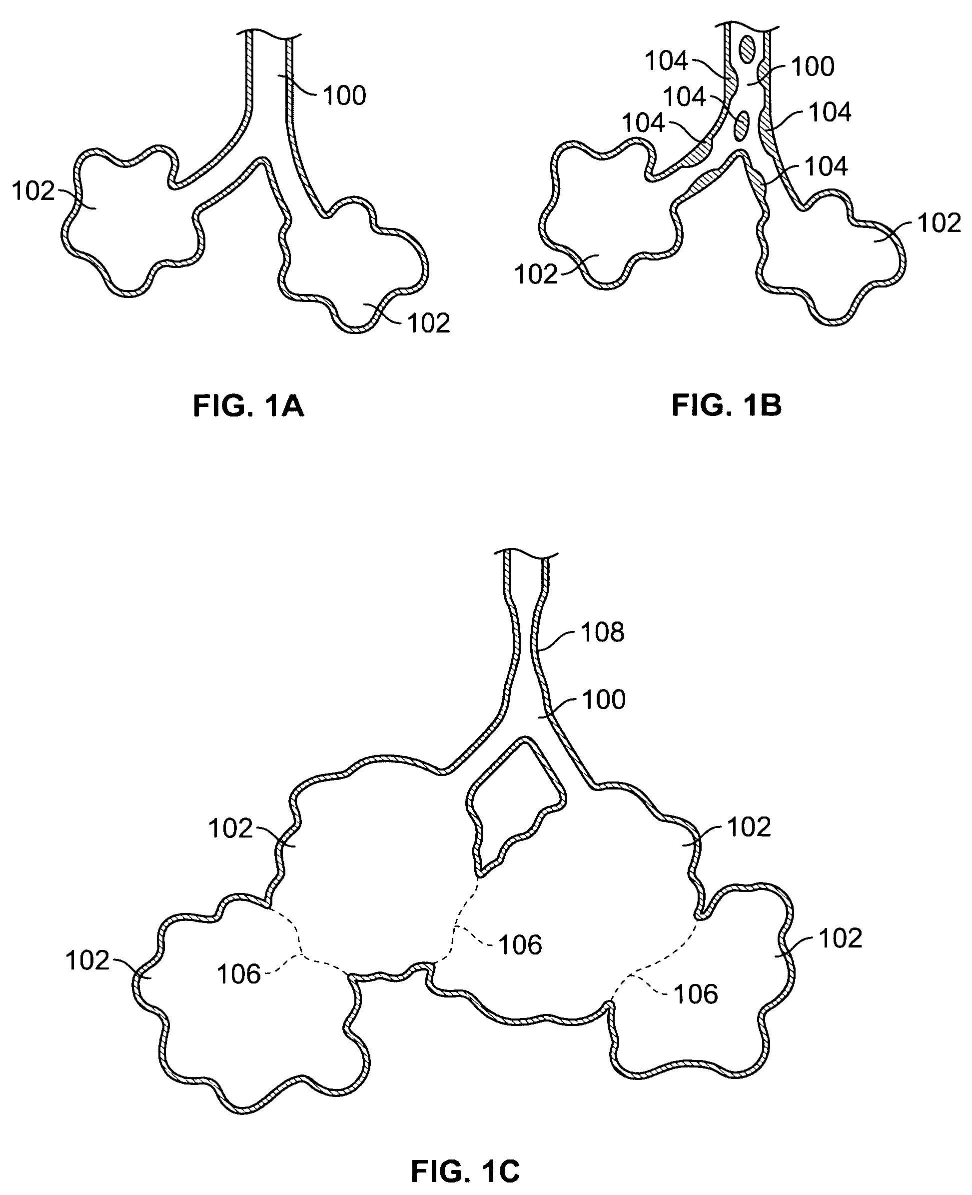 Methods and devices for maintaining surgically created channels in a body organ