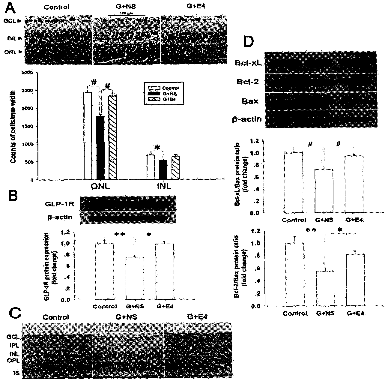 Use of glucagons-like peptide-1 analogue in preparation of ophthalmic disease drug