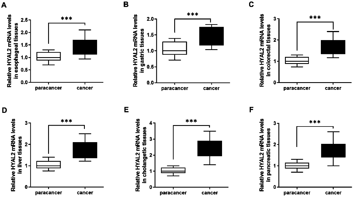 Digestive system malignant tumor marker, and method for preparing drugs for restraining digestive system malignant tumors