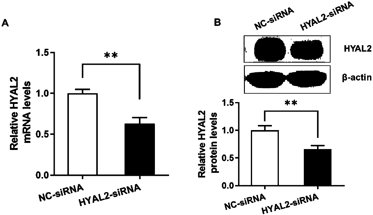 Digestive system malignant tumor marker, and method for preparing drugs for restraining digestive system malignant tumors