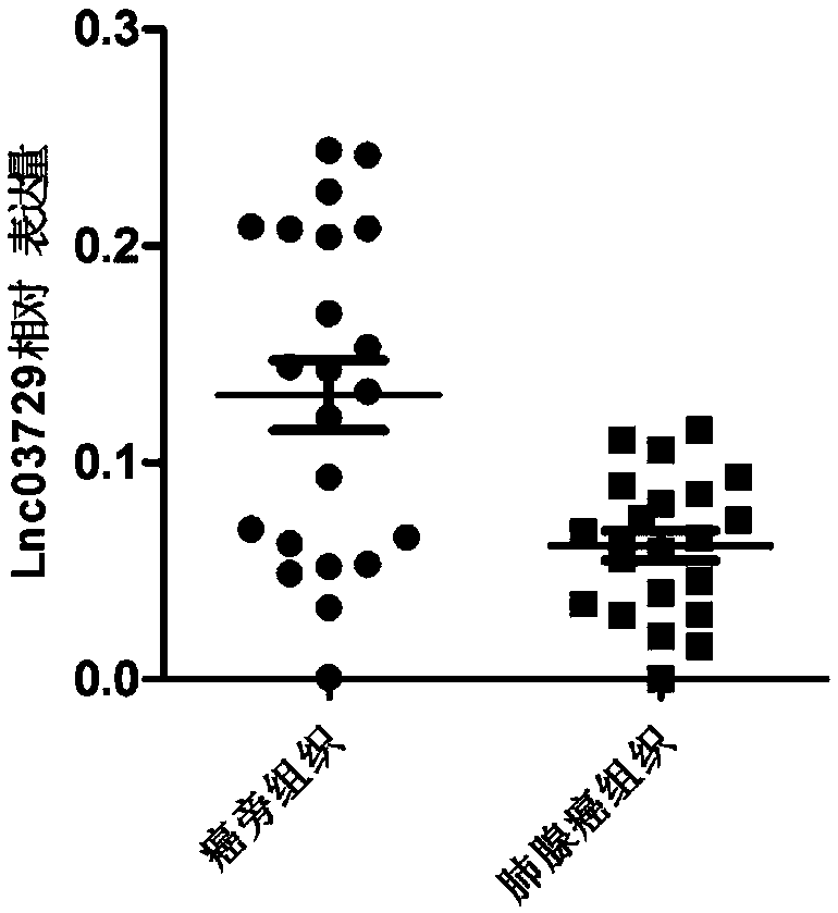 Application of Lnc03729 gene as biomarker in lung adenocarcinoma pre-diagnosis reagent