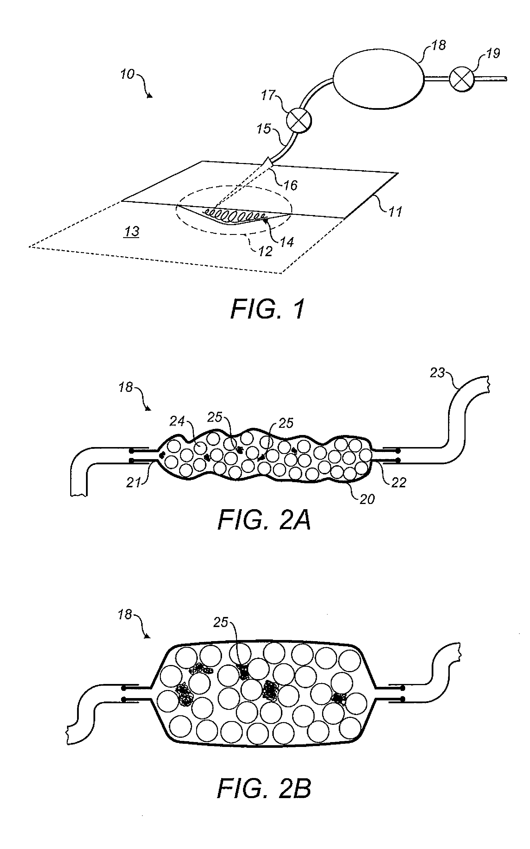 Negative pressure device