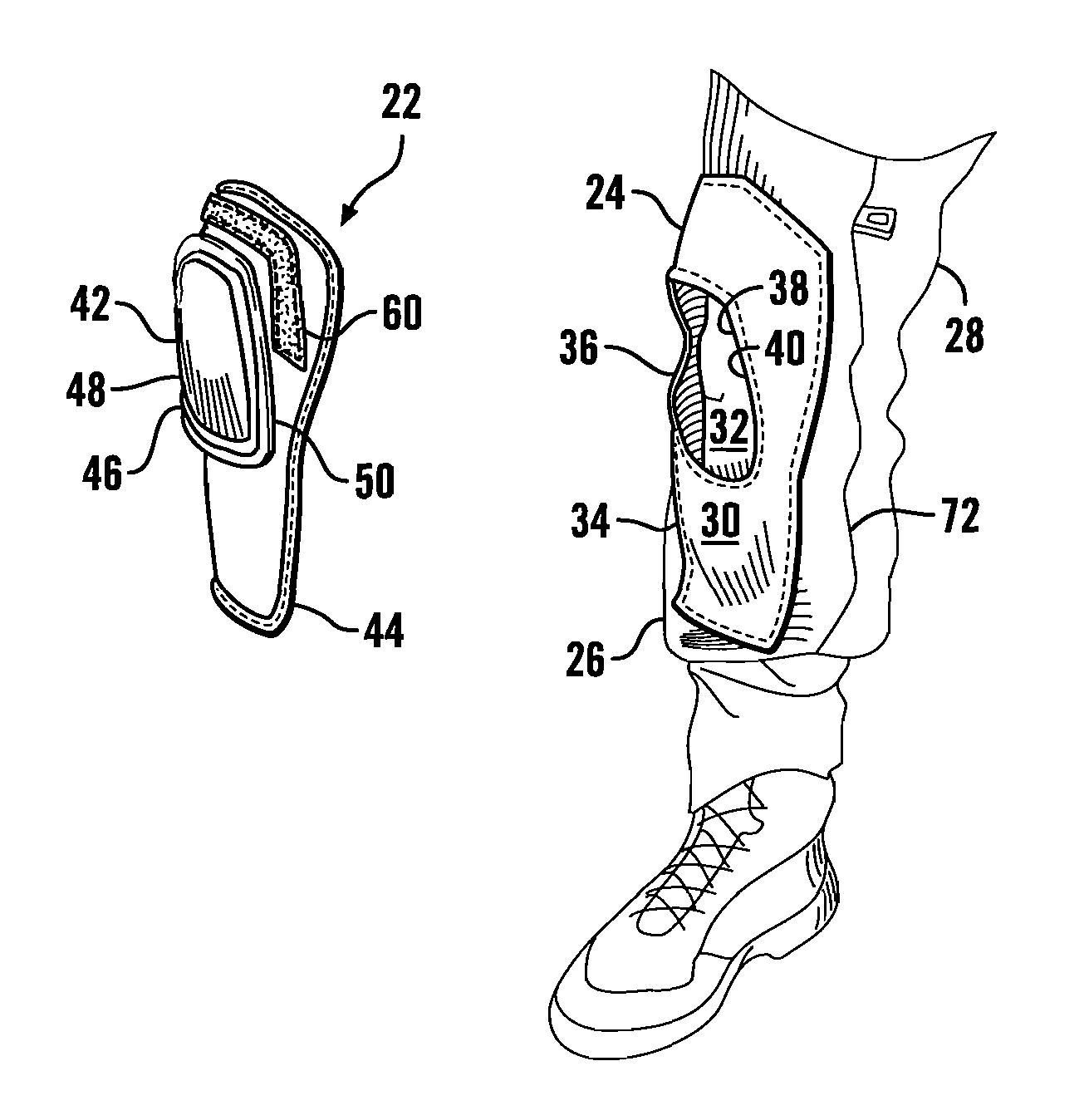 Removable garment protective assembly