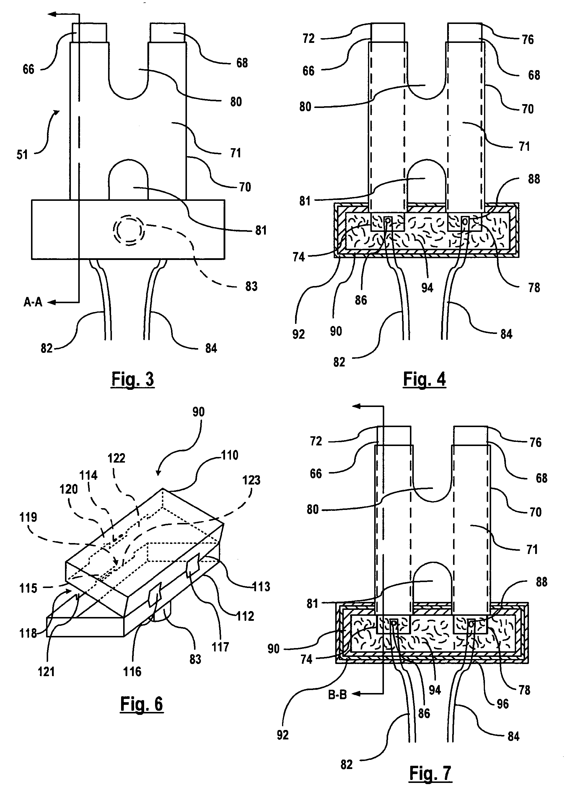 Electrical connection in glazing operations