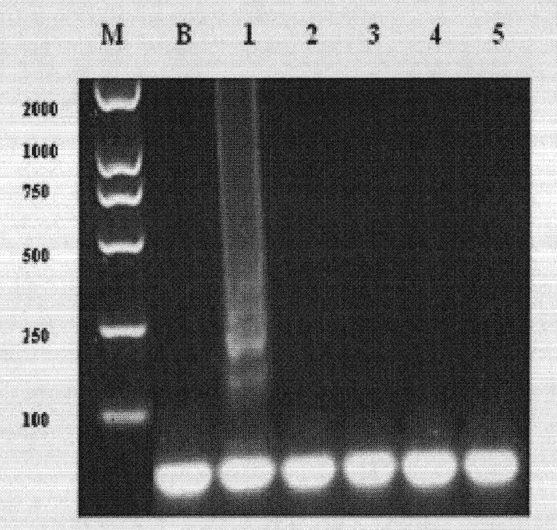 Specific primer group, kit comprising the primer group, use method and detection method