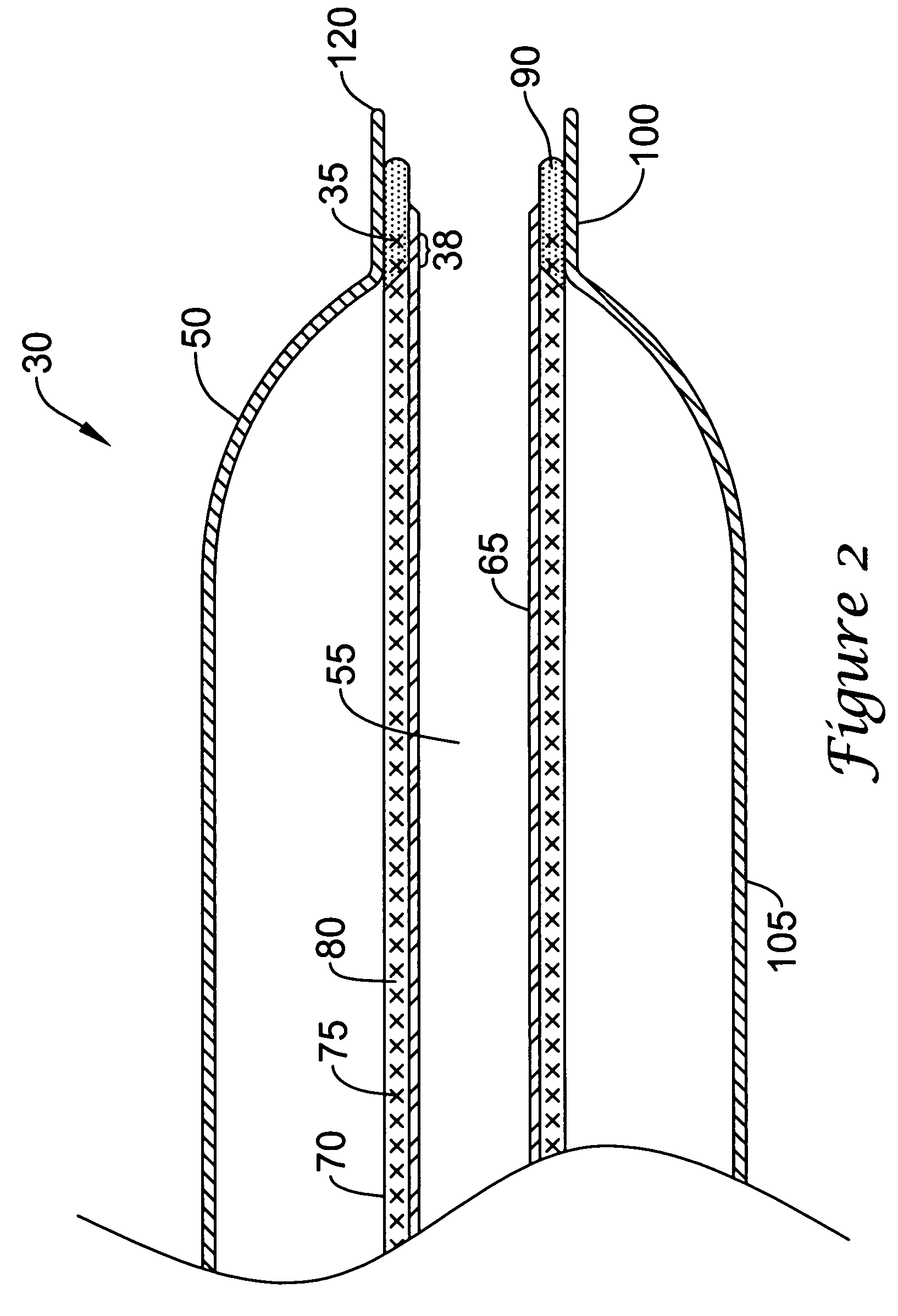 Catheter having an ultra soft tip and methods for making the same