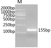 Quantitative detection method of tea moth nucleopolyhedrosis virus