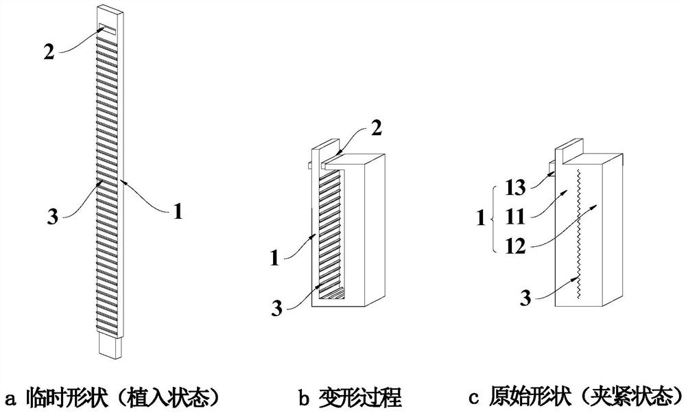 Ligation clip with shape memory function