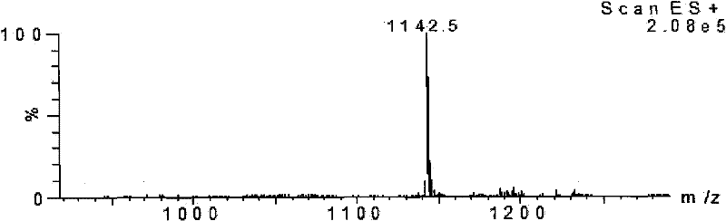 MAGE (Melanoma Antigen Gene)-4 anti-tumor CTL (Cytotoxic T Lymphocyte) epitope peptide and application thereof